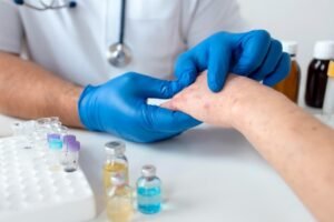 Best Skin Infections Treatment In Afzalpur Ghaziabad