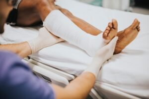 Fracture Treatment specialist examining a patient’s leg with a cast