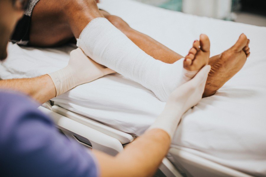 Fracture Treatment specialist examining a patient’s leg with a cast